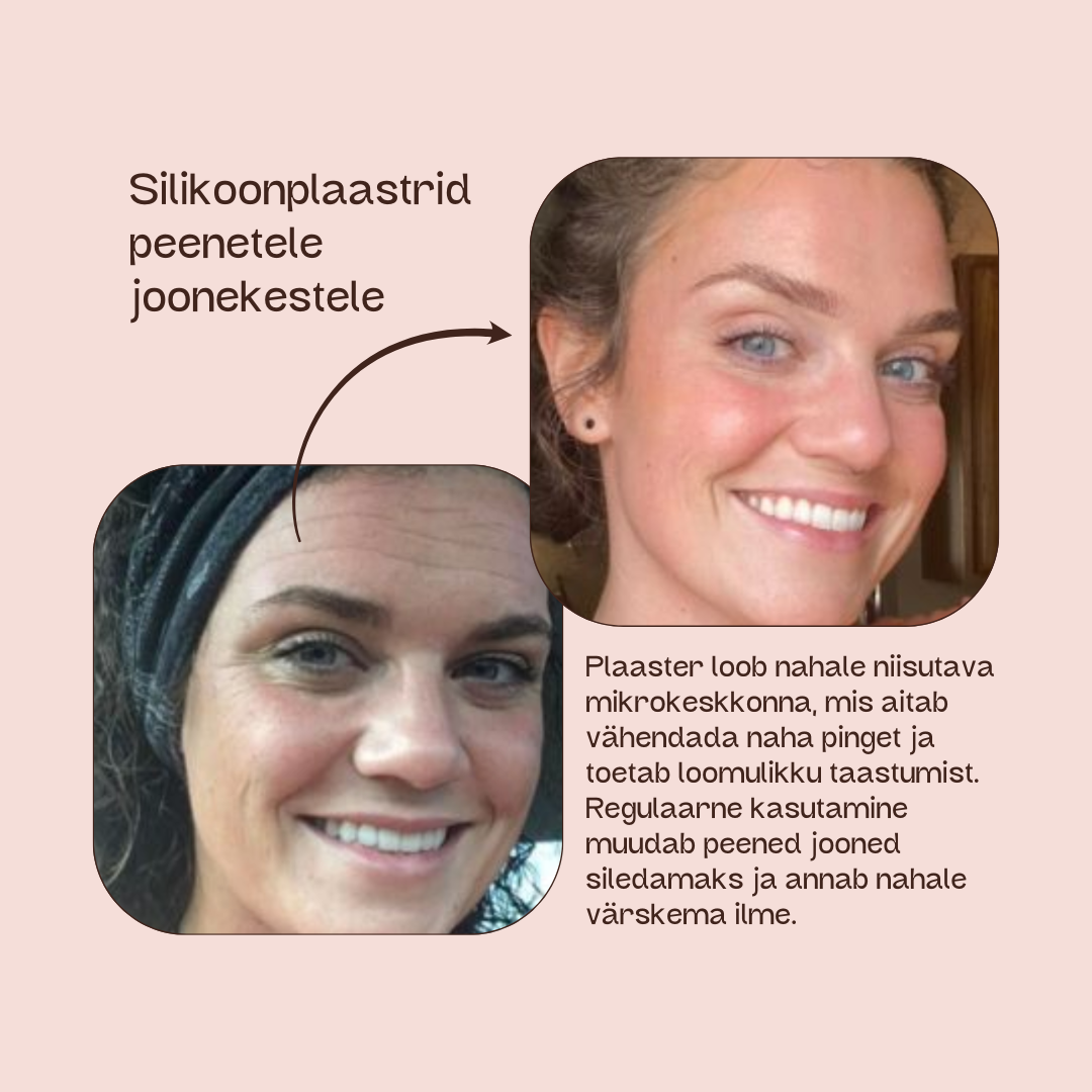 Silikoonteip