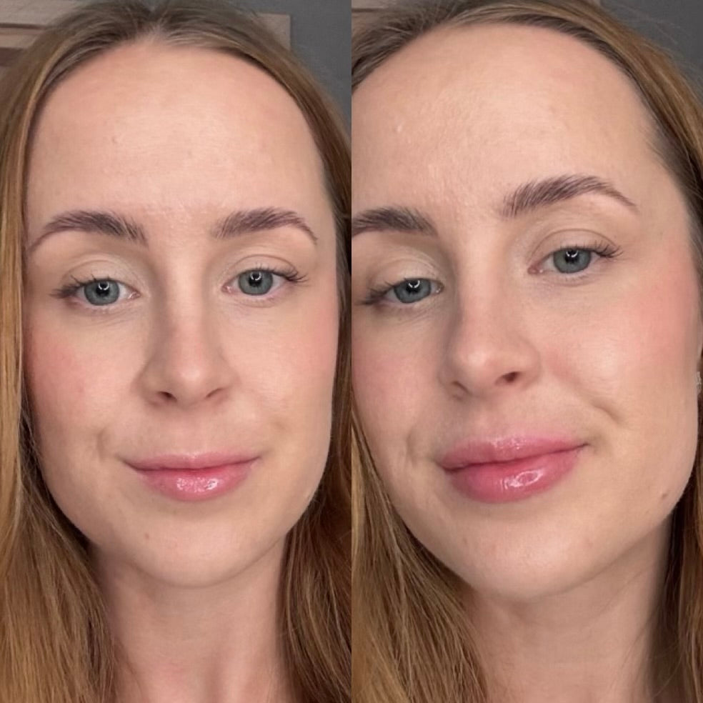 Suurendav huuleläige