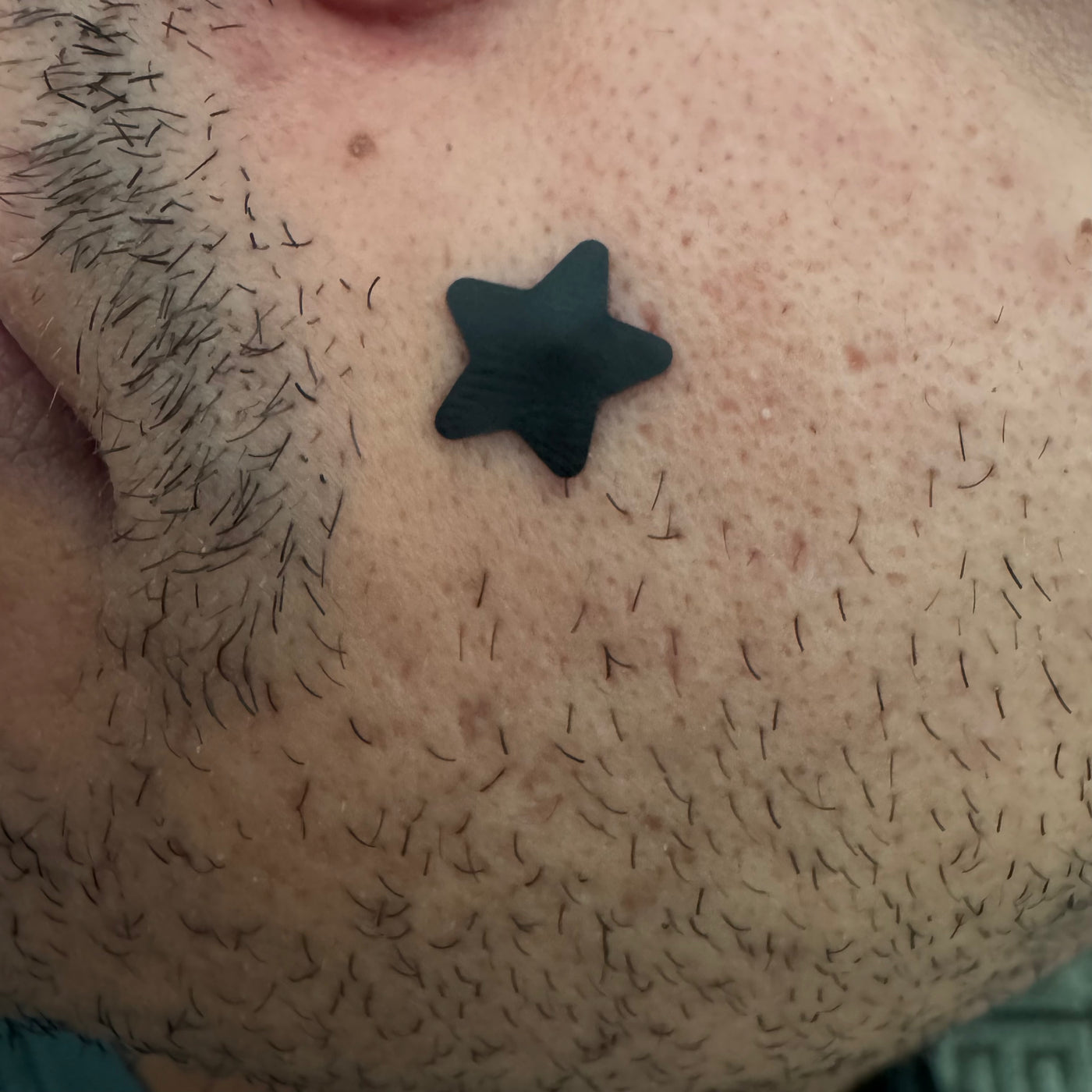 KKK
